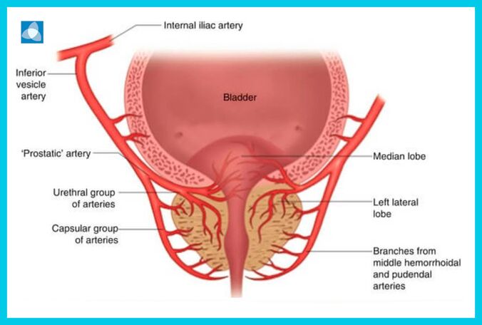 Prostate presentation