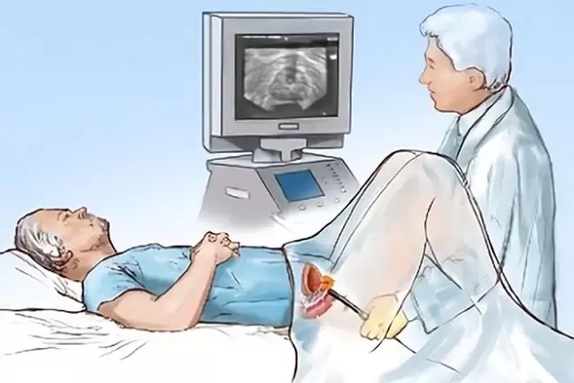prostatitis diagnosis